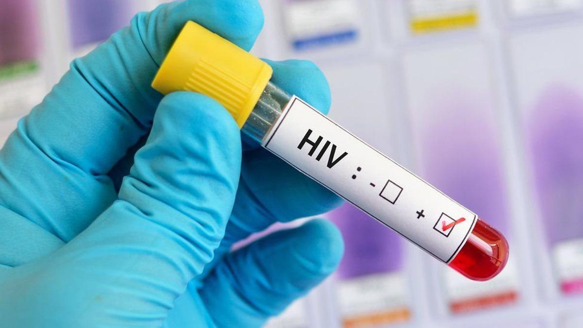Moderna: Comienzan los ensayos en humanos de una vacuna contra el VIH con ARN mensajero thumbnail
